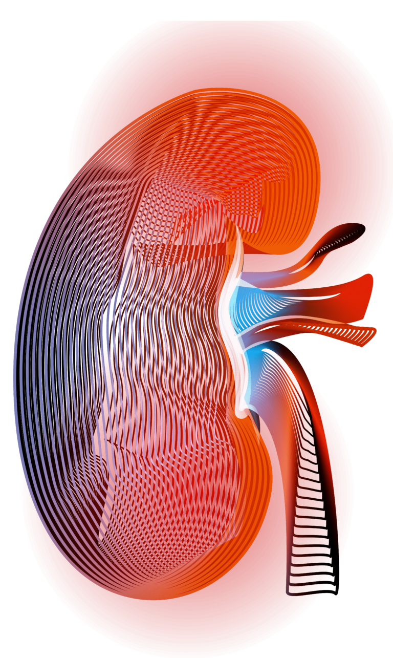 World Kidney Stone Day — Dornier MedTech