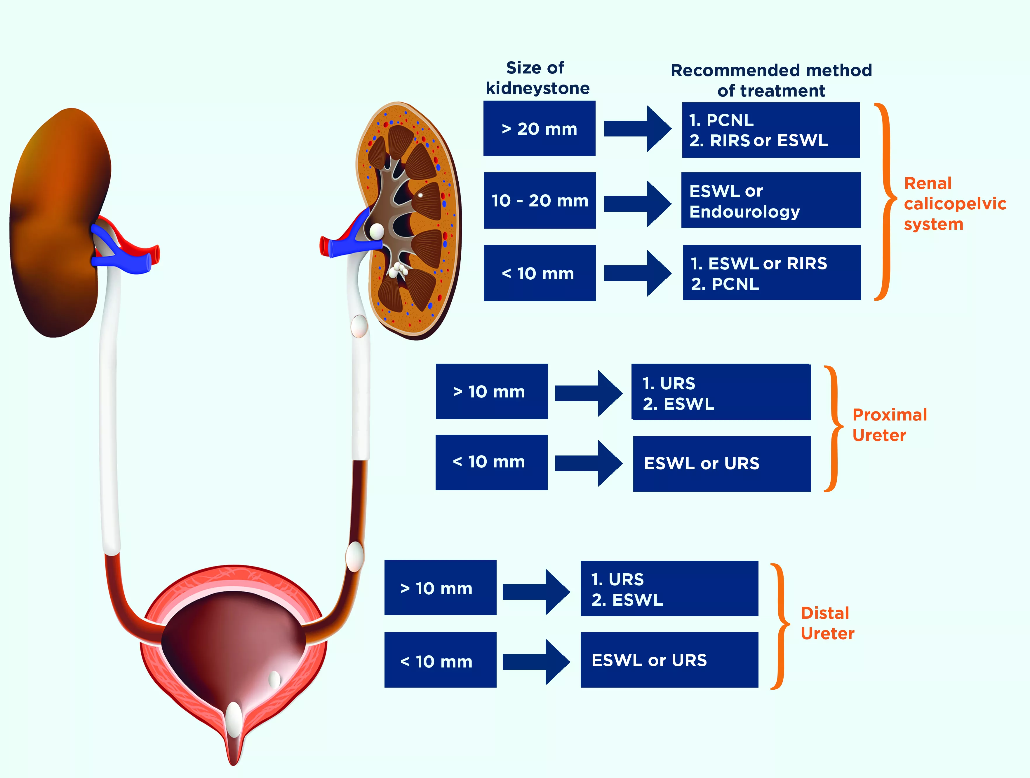 Kidney Stone Chart