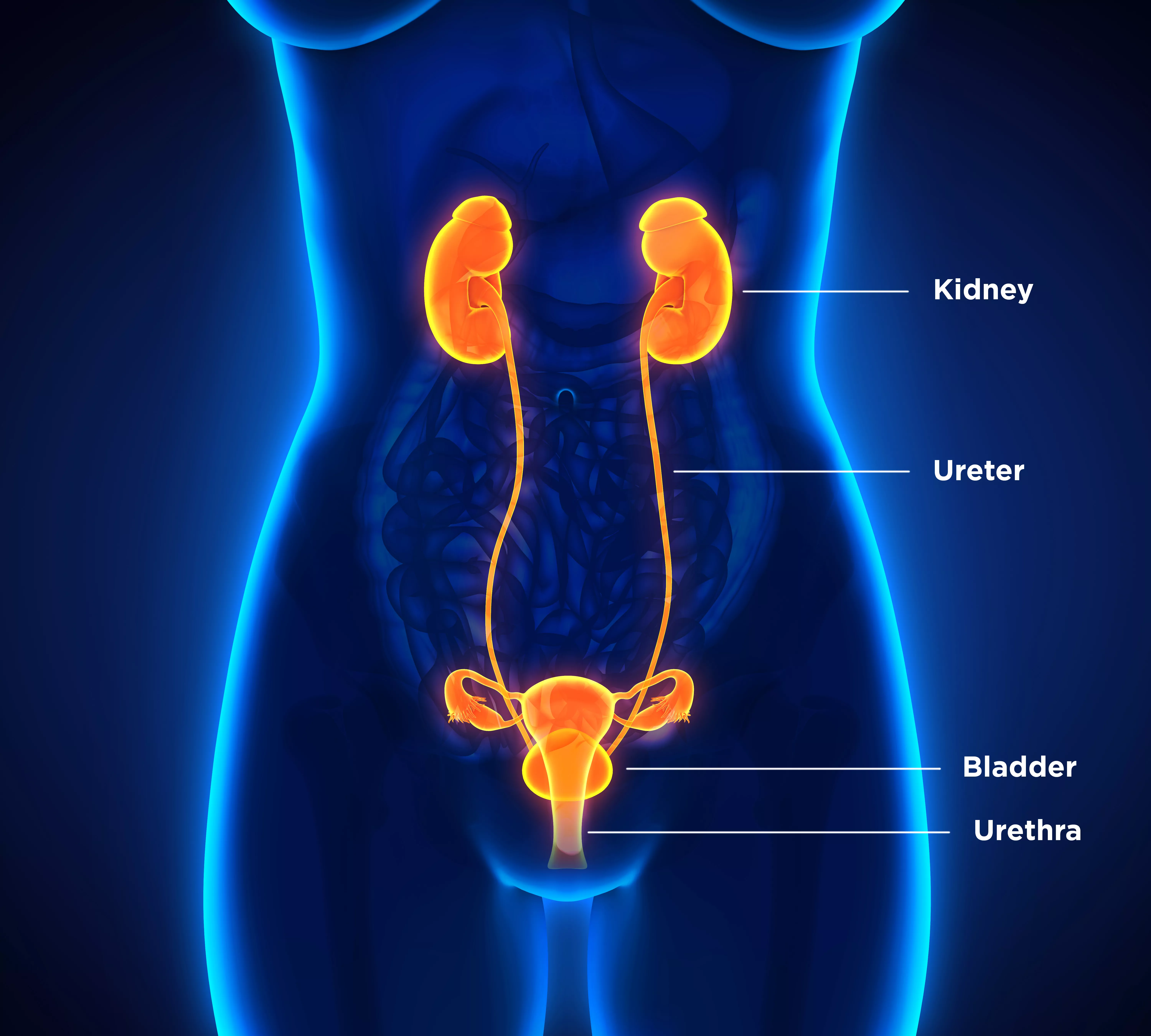 Kidney Stones - South Valley Urology